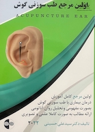 اولین مرجع طب سوزنی گوش 2022